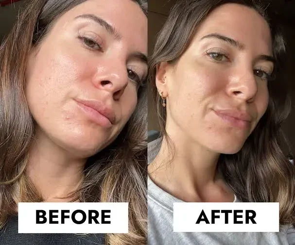 CeraVe Blemish Control Gel Moisturiser with 2% Salicylic Acid &amp; Niacinamide for Blemish-Prone Skin 40ml - Image 4