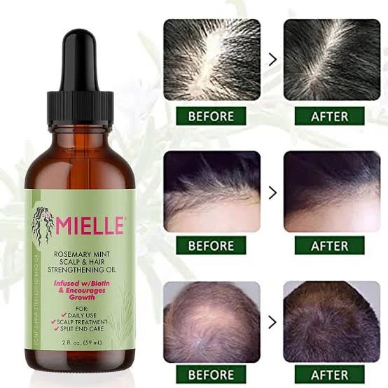 Mielle Rosemary Mint Scalp & Hair Strengthening Oil 59 - Ml - Image 3
